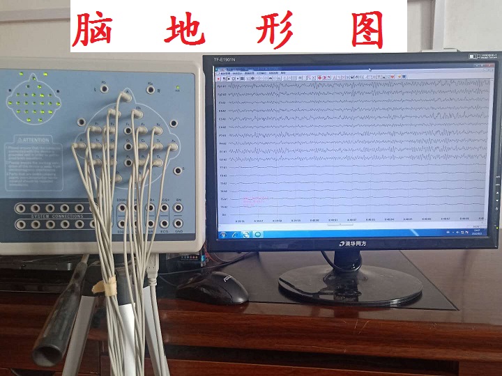 脑地形图.jpg