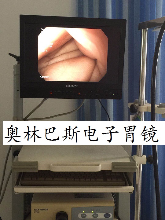 奥林巴斯电子胃镜.jpg